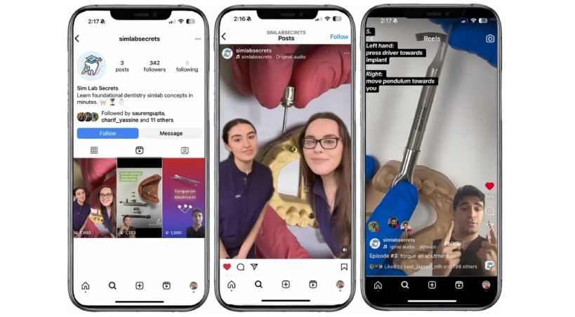 Explorando el papel de los Reels de Instagram en la educación predoctoral en implantes dentales