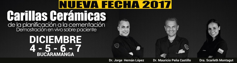 Carillas cerámicas - Bucaramanga