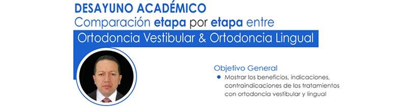 Comparación etapa por etapa entre Ortodoncia Vestibular & Ortodoncia Lingual