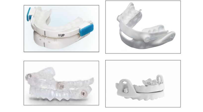Dispositivos de avance mandibular en la apnea obstructiva del sueño 