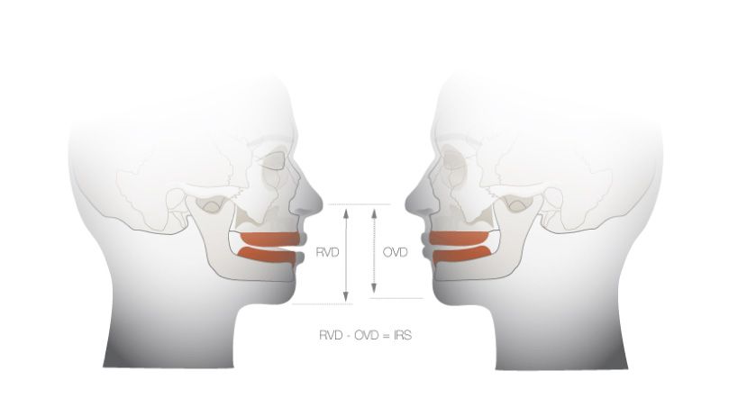 Dimensión vertical en prostodoncia, teoría y práctica