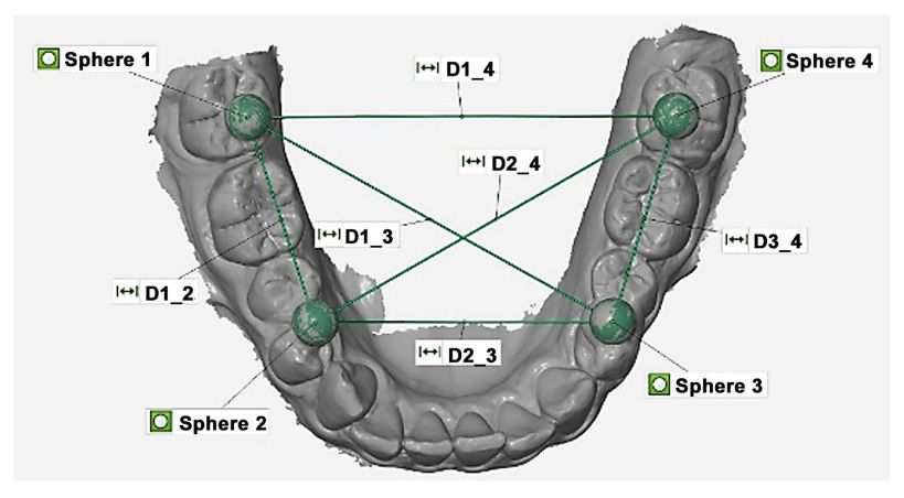 Estudio clínico sobre la precisión de los escáneres intraorales inalámbricos para impresiones digitales de arco completo en arcadas dentadas
